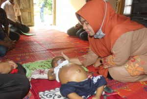 Ketua TP. PKK Pasbar Sifrowati Yulianto Mengunjungi Bayi Bernama Afis Rahadian Menderita Pembengkakan di Perut