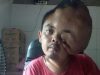 Viqri Gunawan Berharap Bantuan Dermawan untuk Biaya Pengobatan Tumor Ganas